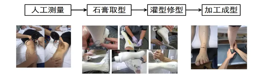  Manufacturing Process of Traditional Gypsum Ankle Foot Orthosis